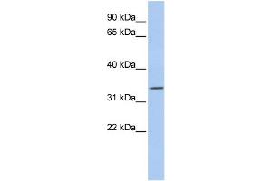 WB Suggested Anti-PITX1 Antibody Titration:  0. (PITX1 Antikörper  (N-Term))