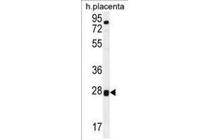 TOR2A Antibody (Center) western blot analysis in human placenta tissue lysates (35 µg/lane).