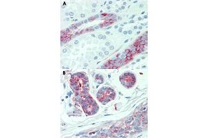 Immunohistochemical staining of human kidney (A) and human breast (B) with SLC4A2 polyclonal antibody . (SLC4A2 Antikörper  (Internal Region))