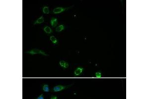 Immunofluorescence analysis of MCF-7 cells using HFE Polyclonal Antibody (HFE Antikörper)