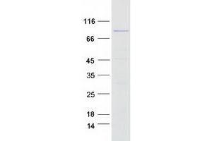 Western Blotting (WB) image for MutS Homolog 5 (MSH5) (Transcript Variant 3) protein (Myc-DYKDDDDK Tag) (ABIN2726436)