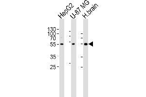 Western blot analysis of lysates from HepG2, U-87 MG cell line and human brain tissue lysate(from left to right), using RGS20 Antibody (Center) (ABIN6243829 and ABIN6577411). (RGS20 Antikörper  (AA 150-184))