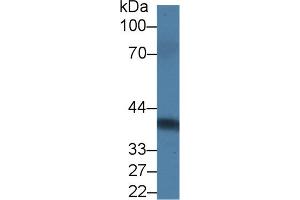 Detection of PRLR in Rat Serum using Polyclonal Antibody to Prolactin Receptor (PRLR) (Prolactin Receptor Antikörper  (AA 20-229))