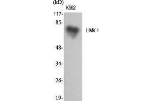 Western Blotting (WB) image for anti-LIM Domain Kinase 1 (LIMK1) (Internal Region) antibody (ABIN6284007)