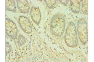 Immunohistochemistry of paraffin-embedded human colon tissue using ABIN7145070 at dilution of 1:100 (COQ8A Antikörper  (AA 1-220))