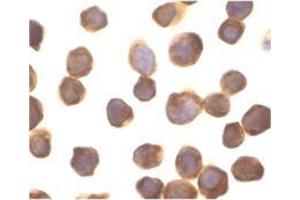Immunocytochemistry of ZIP kinase in Jurkat cells with this product at 10 μg/ml. (DAPK3 Antikörper  (Center))