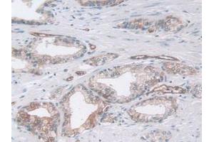 IHC-P analysis of Human Prostate Gland Tissue, with DAB staining. (Pepsin Antikörper)