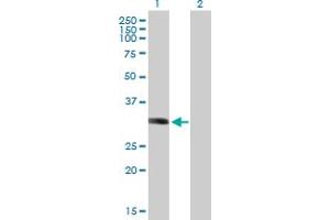 Western Blot analysis of LYSMD2 expression in transfected 293T cell line by LYSMD2 MaxPab polyclonal antibody. (LYSMD2 Antikörper  (AA 1-215))