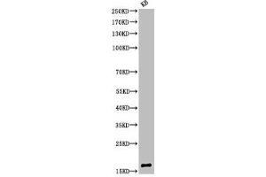Western Blot analysis of KB cells using Acetyl-Histone H3 (K9) Polyclonal Antibody (HIST1H3A/HIST2H3A/H3F3A (acLys9) Antikörper)