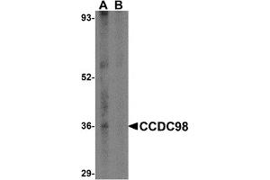 Western Blotting (WB) image for anti-Family with Sequence Similarity 175, Member A (FAM175A) (N-Term) antibody (ABIN1031306)