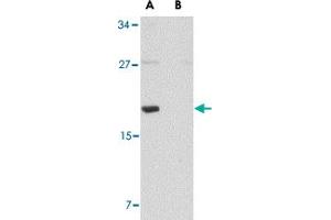 Western blot analysis of MED28 in human brain tissue lysate with MED28 polyclonal antibody  at 1 ug/mL in (A) the absence and (B) the presence of blocking peptide. (MED28 Antikörper  (Internal Region))