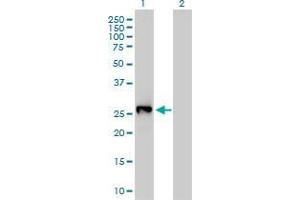 Western Blot analysis of LXN expression in transfected 293T cell line by LXN monoclonal antibody (M01), clone 8H5. (Latexin Antikörper  (AA 151-222))