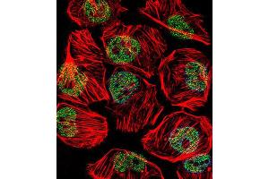 Immunofluorescence (IF) image for anti-TATA Box Binding Protein (TBP) antibody (ABIN3002745) (TBP Antikörper)