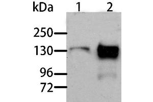 Western Blot analysis of Human liver cancer and normal liver tissue using AOX1 Polyclonal Antibody at dilution of 1:1000 (AOX1 Antikörper)