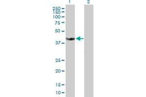Western Blot analysis of STOML1 expression in transfected 293T cell line by STOML1 MaxPab polyclonal antibody. (STOML1 Antikörper  (AA 1-398))