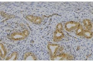 ABIN6277529 at 1/100 staining Human uterus tissue by IHC-P. (GHRH Antikörper  (Internal Region))