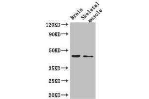 Western Blot Positive WB detected in: Mouse brain tissue, Mouse skeletal muscle tissue All lanes: AJAP1 antibody at 2. (AJAP1 Antikörper  (AA 308-394))