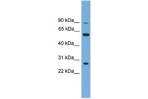 WB Suggested Anti-IMPDH2  Antibody Titration: 0. (IMPDH2 Antikörper  (N-Term))