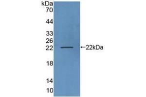 Detection of Recombinant LAMP3, Human using Polyclonal Antibody to Lysosomal Associated Membrane Protein 3 (LAMP3) (LAMP3 Antikörper  (AA 222-381))