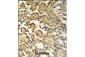 Immunohistochemistry (Paraffin-embedded Sections) (IHC (p)) image for anti-X-Box Binding Protein 1 (XBP1) (AA 62-91) antibody (ABIN651279)