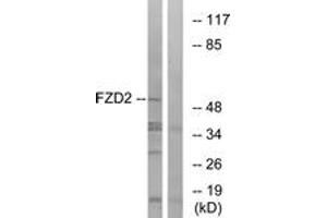 Western blot analysis of extracts from HeLa cells, using FZD2 Antibody.