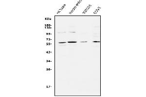 Western blot analysis of APEX2 using anti-APEX2 antibody (ABIN5518737). (APEX2 Antikörper  (AA 102-210))