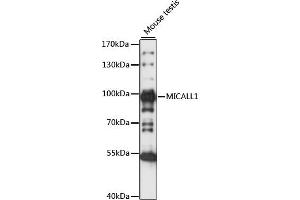 Western blot analysis of extracts of Mouse testis, using MIC antibody (ABIN7268510) at 1:1000 dilution. (MICAL-Like 1 Antikörper  (AA 614-863))
