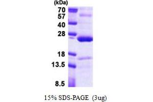 SDS-PAGE (SDS) image for Tumor Necrosis Factor, alpha-Induced Protein 8 (TNFAIP8) (AA 1-198) protein (His tag) (ABIN5853025)