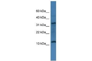 WB Suggested Anti-C14orf177 Antibody Titration: 0. (C14ORF177 Antikörper  (N-Term))