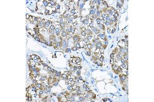 Immunohistochemistry (IHC) image for anti-Ubiquitin-Conjugating Enzyme E2F (UBE2F) (AA 1-185) antibody (ABIN6149794)