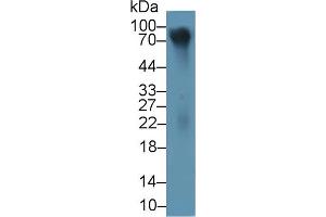 Detection of LUM in Human Cartilage lysate using Polyclonal Antibody to Lumican (LUM) (LUM Antikörper  (AA 19-338))
