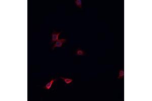 ABIN6268845 staining HeLa cells by IF/ICC. (NRF1 Antikörper  (Internal Region))