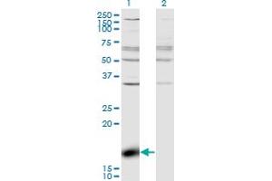 Western Blot analysis of ZBP1 expression in transfected 293T cell line by ZBP1 monoclonal antibody (M01), clone 2C10. (ZBP1 Antikörper  (AA 2-100))