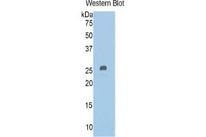 Western Blotting (WB) image for Pappalysin 2 (PAPPA2) ELISA Kit (ABIN6574318)