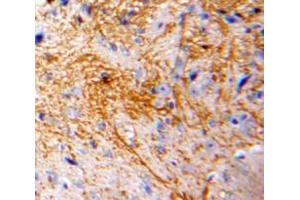 Used in DAB staining on fromalin fixed paraffin-embedded Brain tissue (CCL7 Antikörper  (AA 24-97))