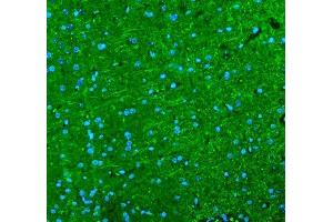 IF analysis of Alpha Internexin using anti-Alpha Internexin antibody (ABIN4886634). (INA Antikörper  (AA 71-161))