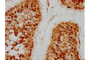 IHC image of ABIN7164157 diluted at 1:200 and staining in paraffin-embedded human testis tissue performed on a Leica BondTM system.