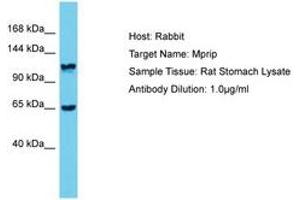 Image no. 1 for anti-Myosin Phosphatase rho Interacting Protein (MPRIP) (AA 771-820) antibody (ABIN6750397) (MPRIP Antikörper  (AA 771-820))