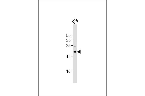 TDGF1 Antikörper  (N-Term)