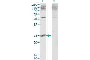 Western Blot analysis of PDAP1 expression in transfected 293T cell line by PDAP1 monoclonal antibody (M05), clone 3B10. (PDAP1 Antikörper  (AA 1-181))
