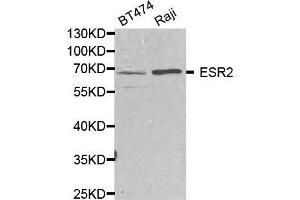 Western blot analysis of extracts of various cell lines, using ESR2 antibody. (ESR2 Antikörper  (AA 1-280))