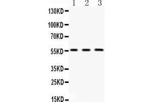 Western blot analysis of FGB expression in rat kidney extract ( Lane 1), mouse liver extract ( Lane 2) and HELA whole cell lysates ( Lane 3). (Fibrinogen beta Chain Antikörper  (Middle Region))