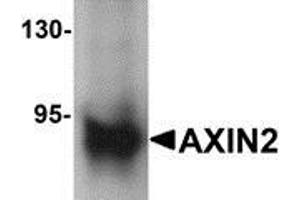 Western blot analysis of AXIN2 in mouse lung lysate with AXIN2 antibody at 1 μg/ml (AXIN2 Antikörper  (C-Term))