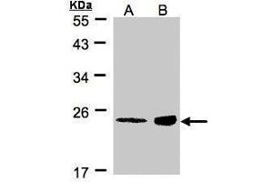 WB Image Sample(30 μg of whole cell lysate) A:MOLT4, B:Raji, 12% SDS PAGE antibody diluted at 1:500 (R-Ras Antikörper  (Center))
