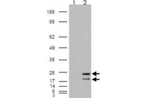 293 overexpressing NRAS and probed with NRAS polyclonal antibody  (mock transfection in first lane), tested by Origene. (GTPase NRas Antikörper  (Internal Region))