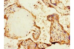 Immunohistochemistry of paraffin-embedded human placenta tissue using ABIN7169067 at dilution of 1:100 (MARK1 Antikörper  (AA 560-700))