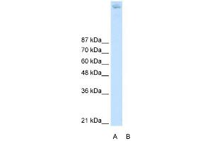 ZBTB38 antibody (20R-1249) used at 0. (ZBTB38 Antikörper  (N-Term))