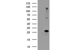 Image no. 1 for anti-Regulatory Factor X-Associated Ankyrin Containing Protein (RFXANK) antibody (ABIN1500684) (RFXANK Antikörper)