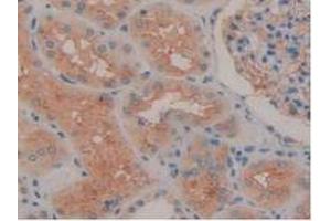 IHC-P analysis of Human Kidney Tissue, with DAB staining. (ENPEP Antikörper  (AA 718-948))