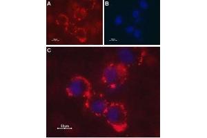 Expression of Latrophilin-1 receptor in SH-SY5Y cell line - Cell surface detection of Latrophilin-1 receptor in intact living human neuroblastoma (SH-SY5Y) cells. (Latrophilin 1 Antikörper  (Extracellular, N-Term))